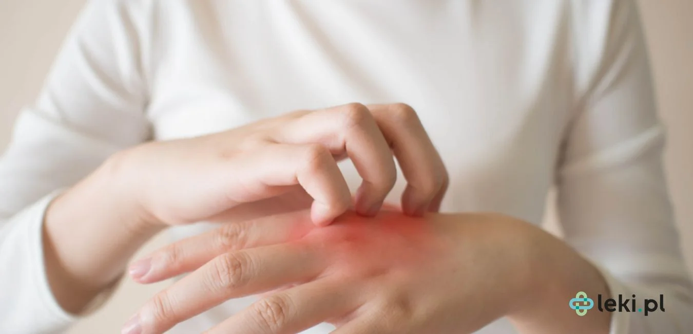 Wapno na alergię — dlaczego nie warto go stosować na uczulenie?