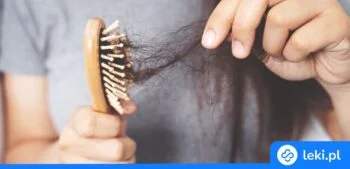 Ilustracja poradnika Przyczyny nadmiernego wypadania włosów – przyczyny i leczenie
