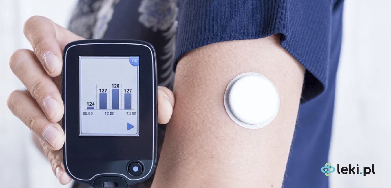 CGM cukrzyca i SGM glukoza – nowoczesny system monitorowania glikemii