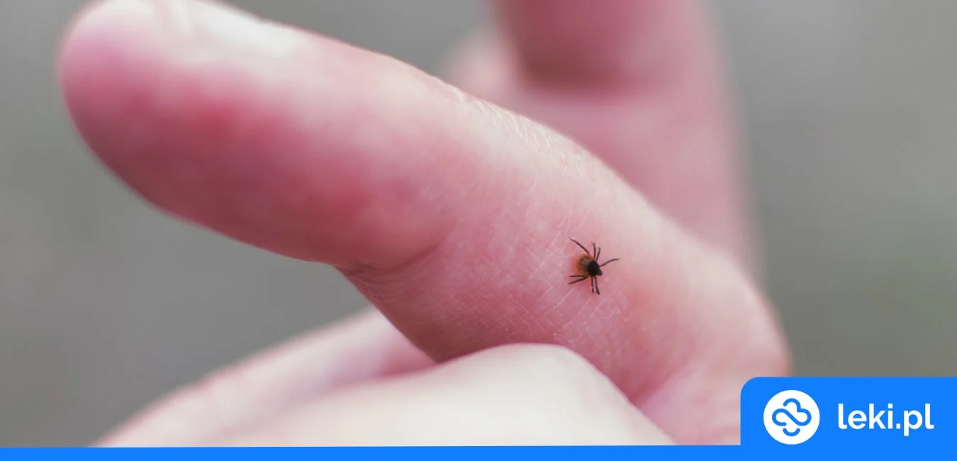 Czym jest borelioza? Poznaj bliżej chorobę z Lyme!