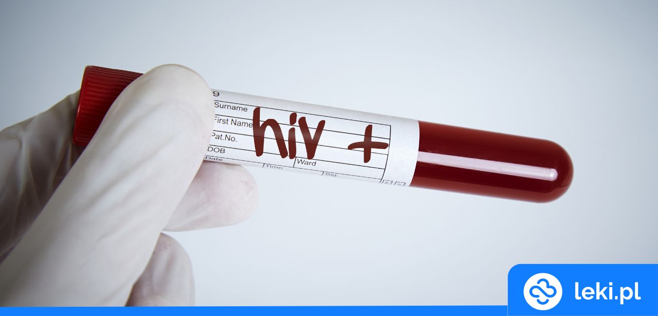 HIV – nowe zastosowanie metforminy