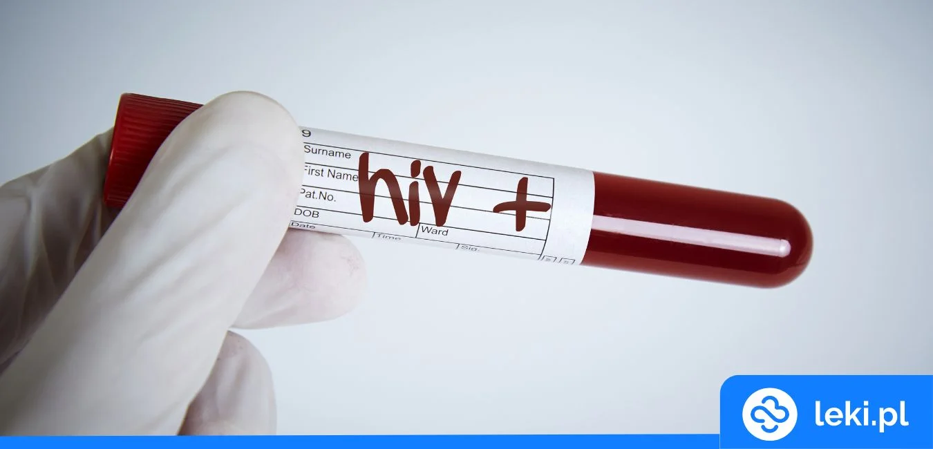 HIV – nowe zastosowanie metforminy