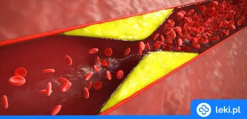 Ilustracja poradnika Nowy lek na hipercholesterolemię