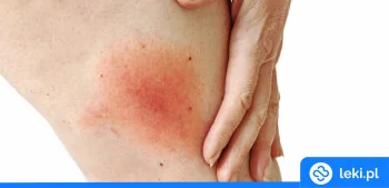 Ilustracja poradnika Szczepionka na boreliozę – najnowsze badania i technologia mRNA