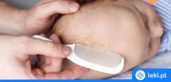 Ilustracja poradnika Jak pozbyć się ciemieniuchy? Przegląd leków i preparatów