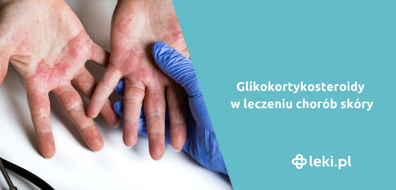 Maść z glikokortykosteroidami – skutki uboczne i bezpieczne stosowanie