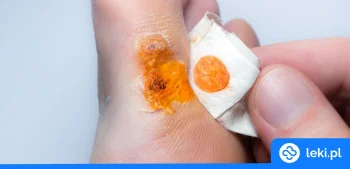 Ilustracja poradnika Stosowanie Rivanolu u dzieci – na co i jak stosować?