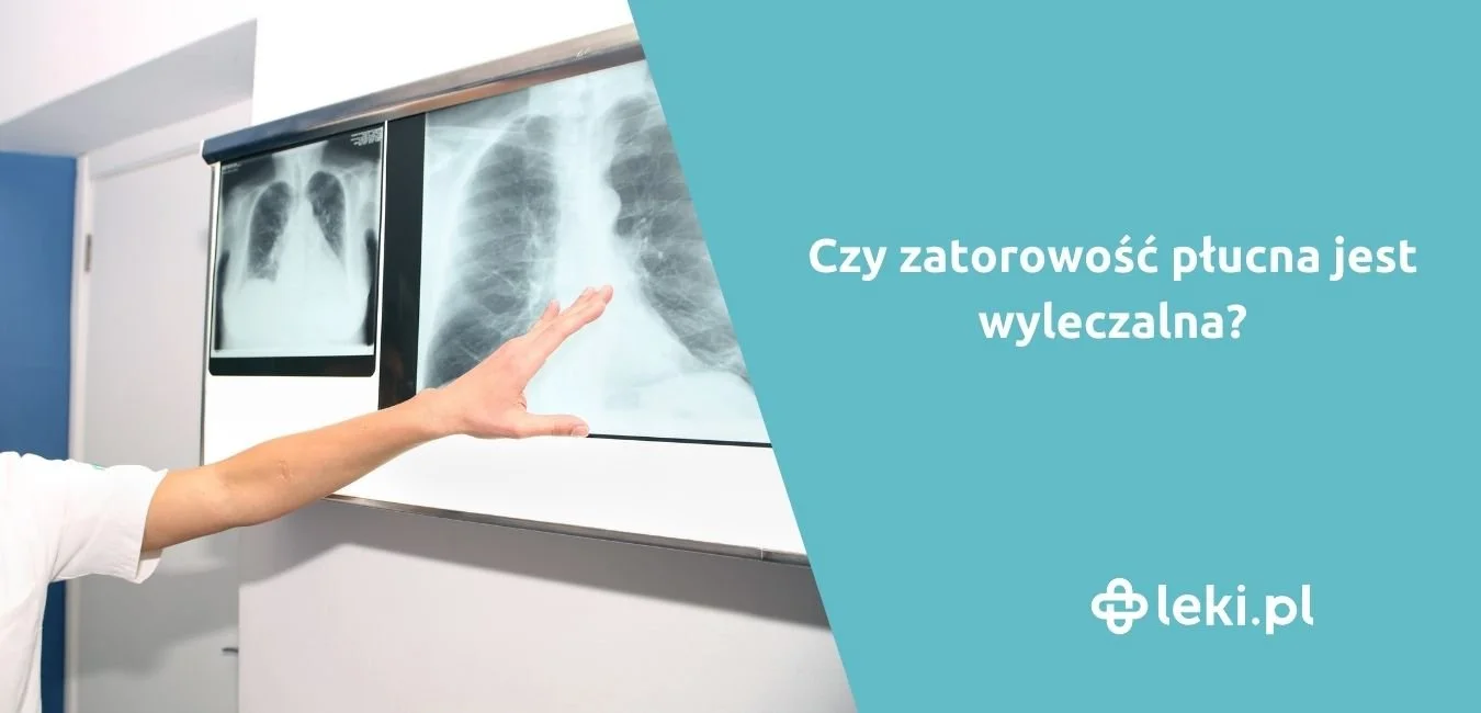 Zatorowość płucna – przyczyny, objawy i leczenie zatoru płucnego