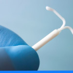 Wkładka hormonalna i miedziana – rodzaje, ceny, kiedy zakładać?