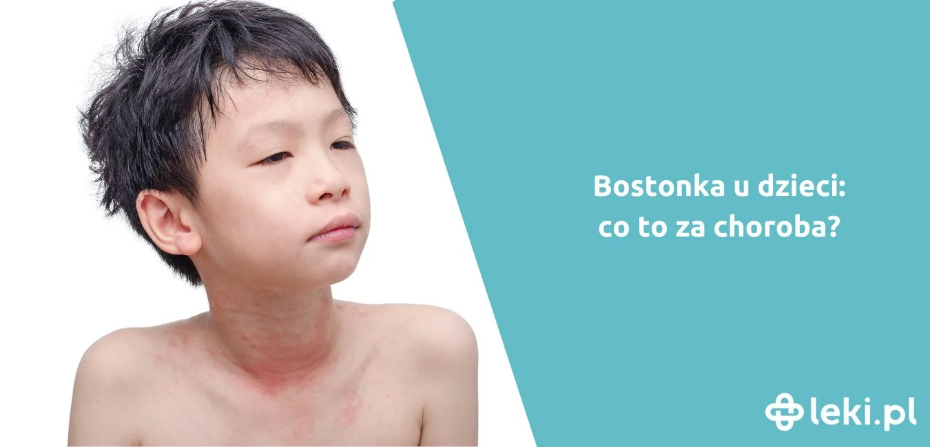 Co to jest bostonka?