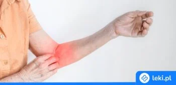 Ilustracja poradnika Najsilniejsze leki przeciwgrzybicze – co wybrać na grzybicę skóry?