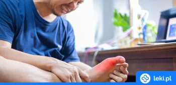 Ilustracja poradnika Jakie leki i zioła obniżają kwas moczowy?