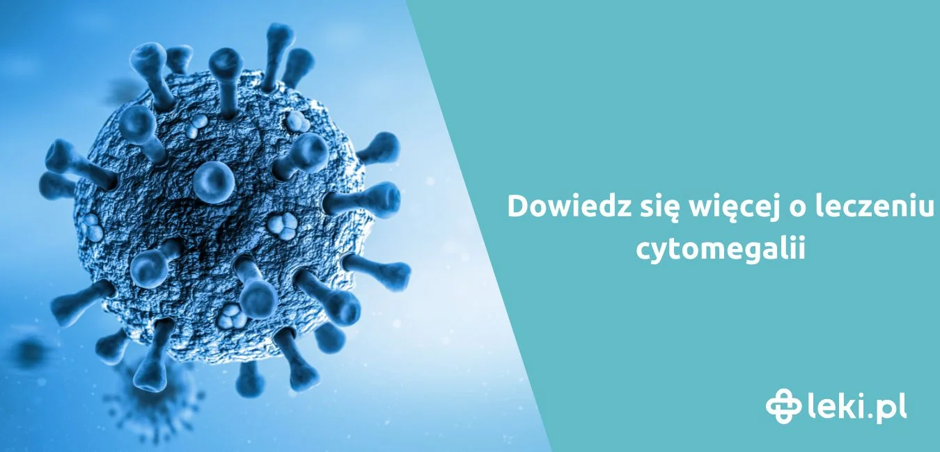 Jak leczyć cytomegalię?