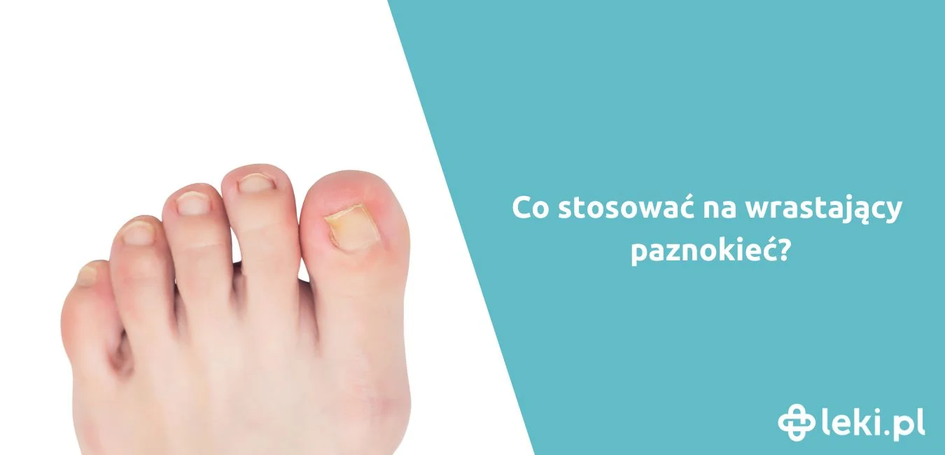 Tribiotic na wrastający paznokieć – maść na stan zapalny i leczenie