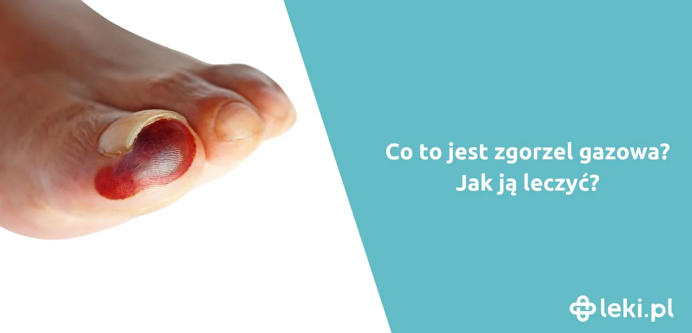 Jak wygląda zgorzel gazowa?