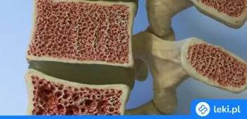 Ilustracja poradnika Nowoczesne leczenie osteoporozy – najskuteczniejsze leki i zastrzyki