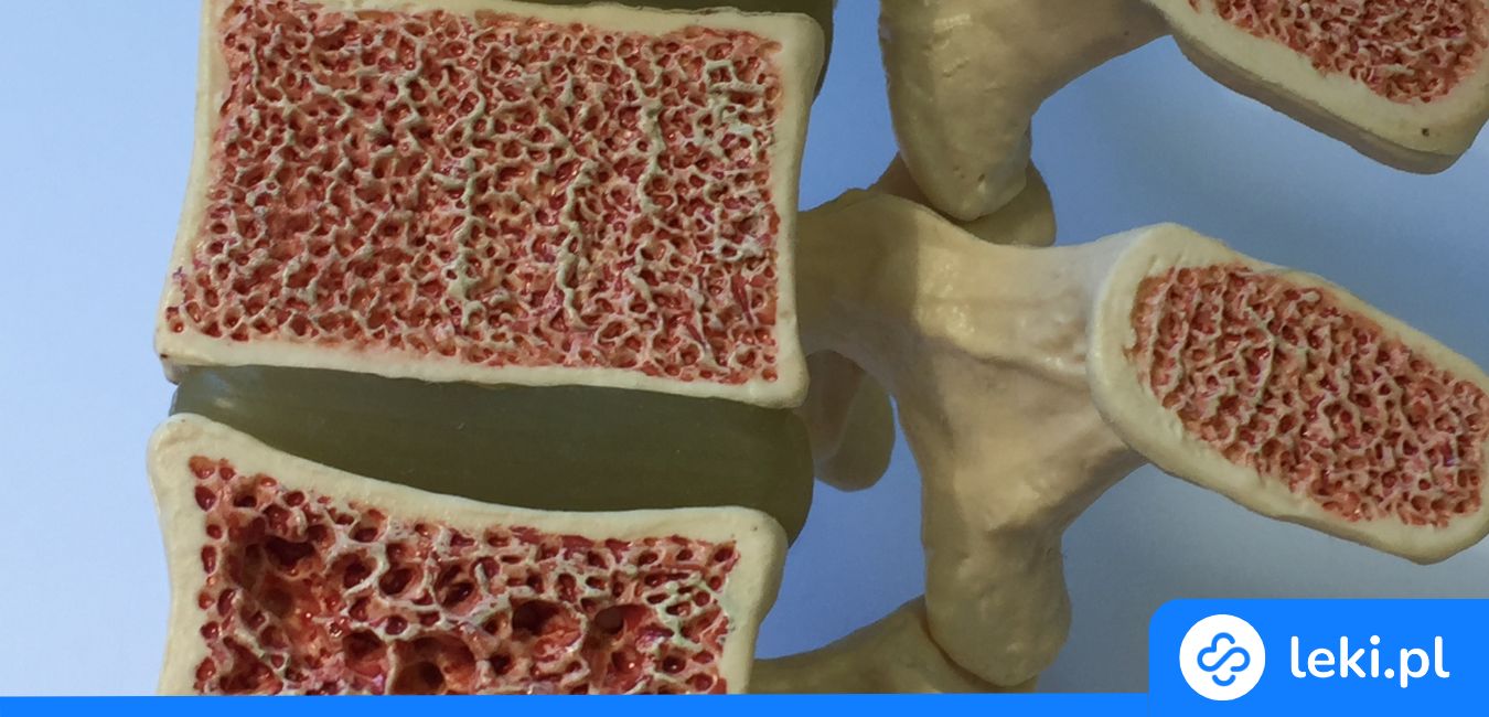 Nowoczesne leczenie osteoporozy – najskuteczniejsze leki i zastrzyki