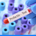 Jak obniżyć poziom prolaktyny? Objawy i leczenie wysokiej prolaktyny