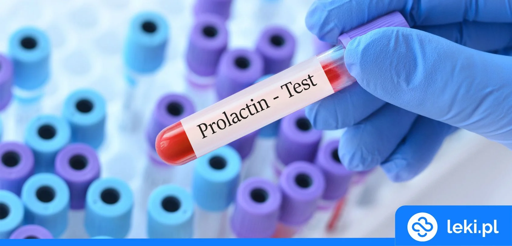 Jak obniżyć poziom prolaktyny? Objawy i leczenie wysokiej prolaktyny