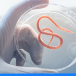 Domowy test na pasożyty – jakie badania i testy kupisz w aptece?