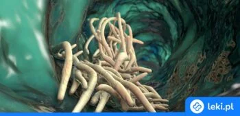 Ilustracja poradnika Domowe sposoby na nicienie u człowieka – objawy, leczenie, leki