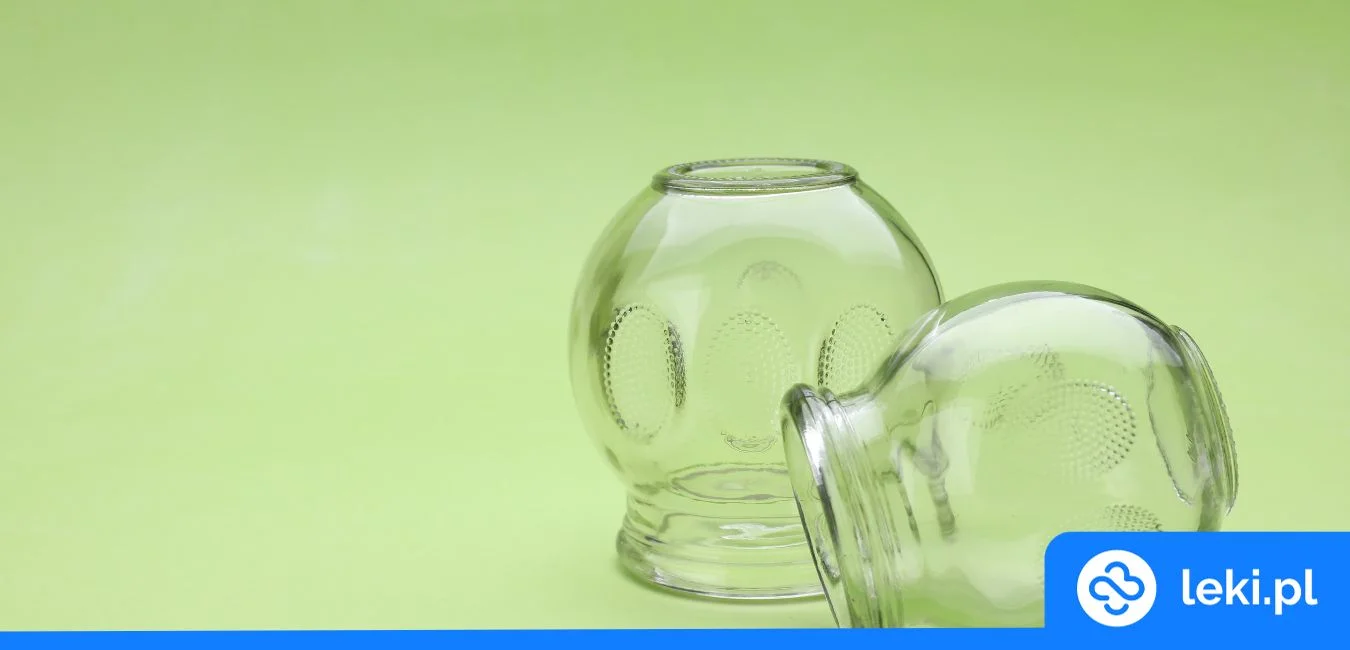 Bańki lekarskie — u kogo i jak je stosować?