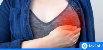 Ilustracja poradnika Co stosować na zapalenie piersi?