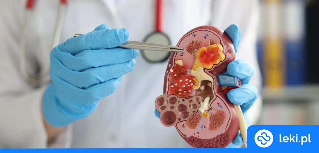 Jak uniknąć chorób nerek?