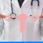 Jak powinna wyglądać suplementacja na PCOS?
