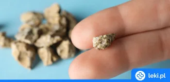 Ilustracja poradnika Jakie są dobre tabletki na kamienie nerkowe?