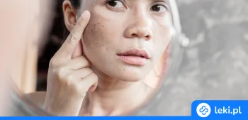 Ilustracja poradnika Jakie są najlepsze dermokosmetyki na przebarwienia skóry?
