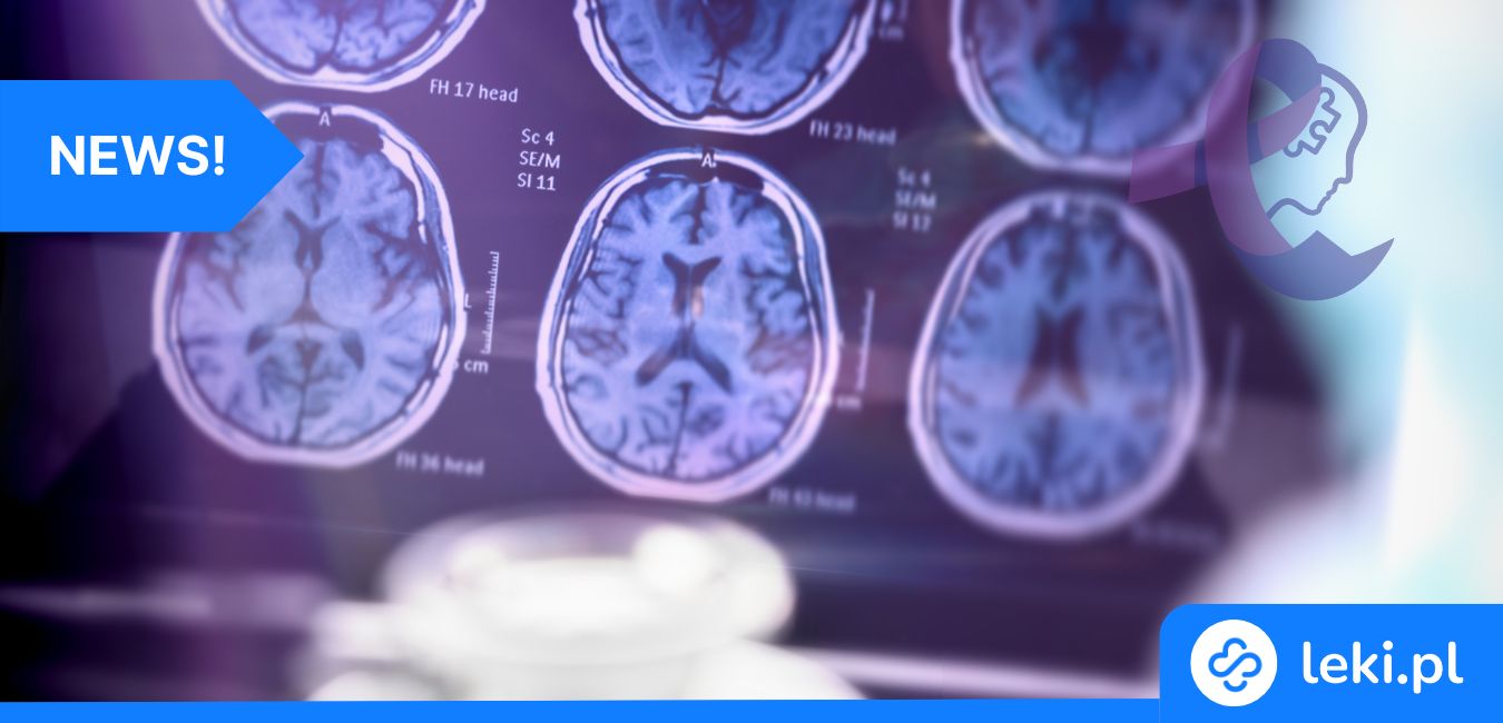 Spray donosowy, który może opóźnić Alzheimera nawet o 10 lat!