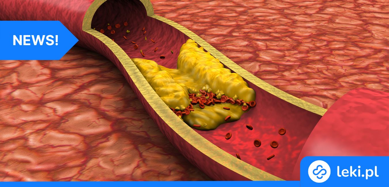 Uwaga na cholesterol! Jego wahania mogą wpływać na pamięć!