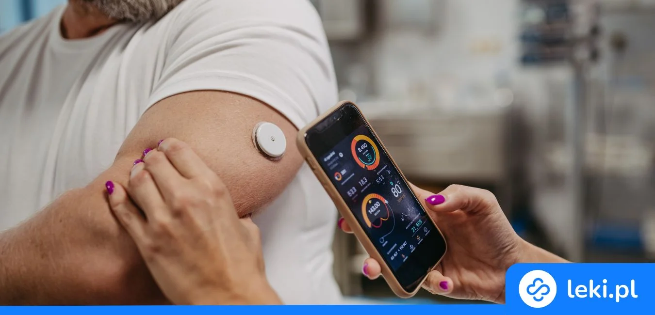 Jak działa sensor do pomiaru cukru? CGM, FGM, cena i gdzie kupić?