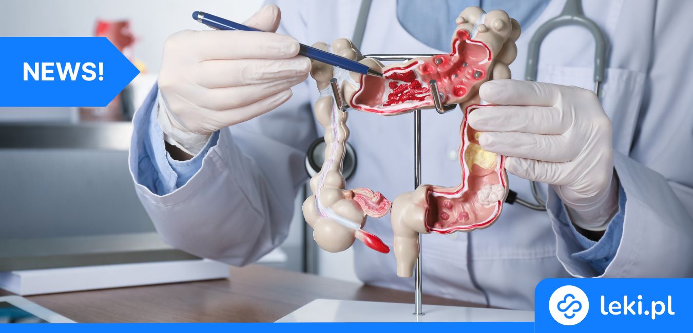 Przełom w onkologii – aspiryna jako broń przeciwko rakowi jelita