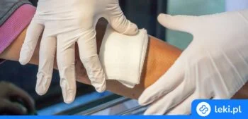 Ilustracja poradnika Jakie są nowoczesne opatrunki na oparzenia?