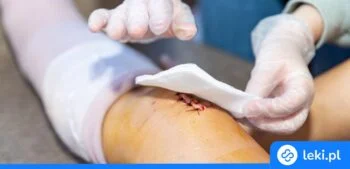 Ilustracja poradnika Jakie opatrunki na odleżyny wybrać? Rodzaje, refundacja, leczenie