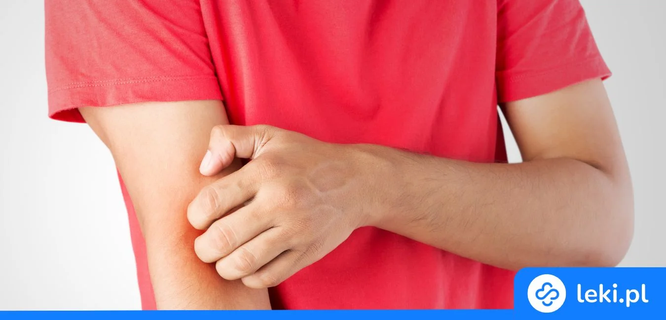 Najlepsze tabletki na pokrzywkę i wysypkę – porady i wskazówki