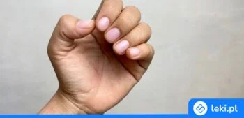 Ilustracja poradnika Zielona bakteria na paznokciu – przyczyny, objawy i skuteczne leczenie