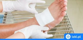 Ilustracja poradnika Jak wyleczyć rany na piętach i stopach? Poznaj skuteczne metody!