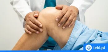 Ilustracja poradnika Jaka maść na torbiel Bakera działa najlepiej? Porównaj skuteczne żele!