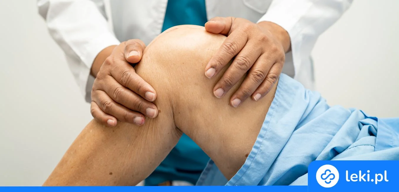 Jaka maść na torbiel Bakera działa najlepiej? Porównaj skuteczne żele!