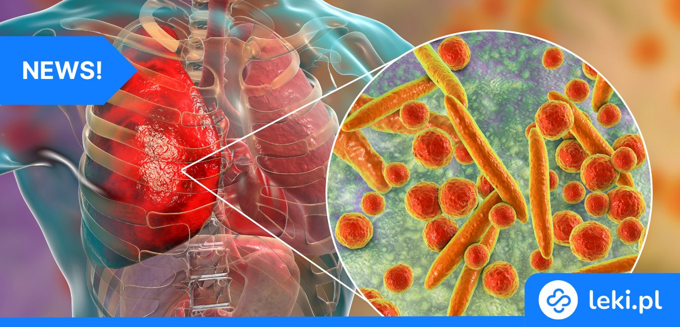 AI diagnozuje zapalenie płuc u dzieci z dokładnością 97,61%