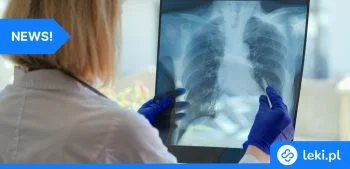 Ilustracja poradnika Genetyka decyduje o skuteczności chemioterapii raka płuc