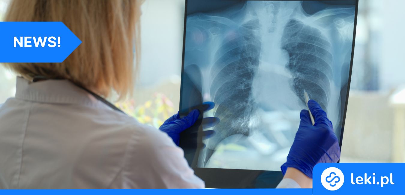 Genetyka decyduje o skuteczności chemioterapii raka płuc