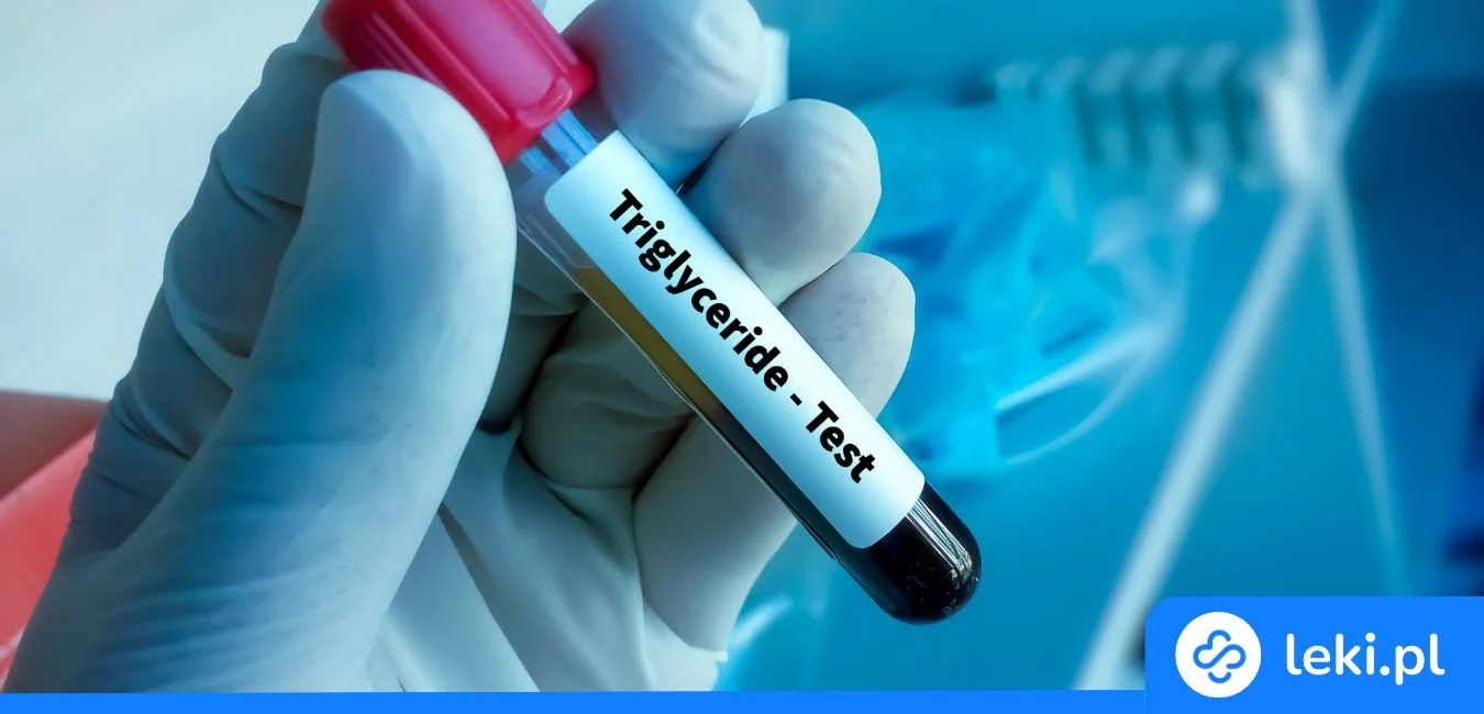 Jak obniżyć trójglicerydy domowymi sposobami? Sprawdź co działa!