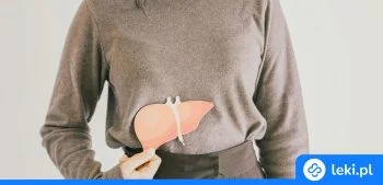 Ilustracja poradnika Plamy na skórze od wątroby i objawy chorej wątroby na skórze – poradnik