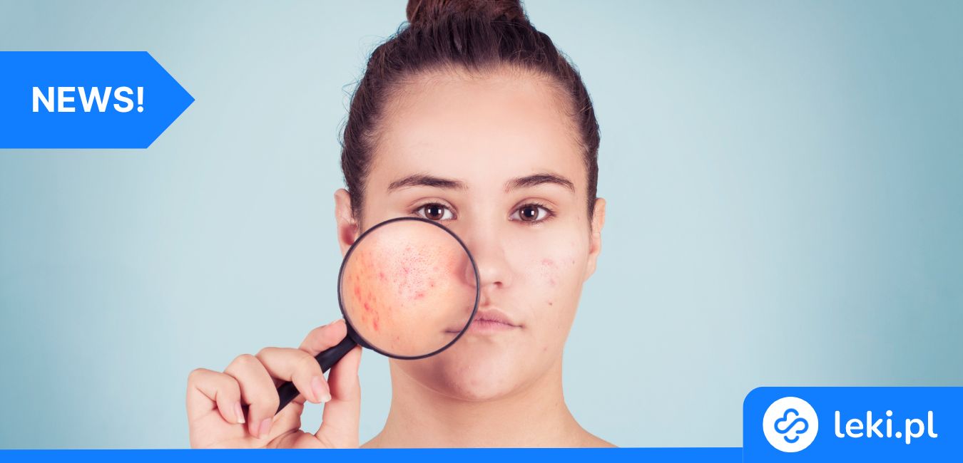 Prebiotyki w kremie – naturalna broń przeciw trądzikowi