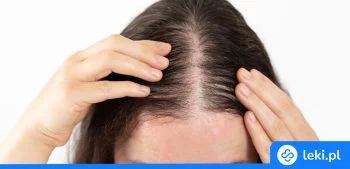 Ilustracja poradnika Wcierka na porost włosów – jak wybrać najlepszą?