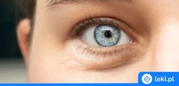 Ilustracja poradnika Worki pod oczami – najlepsze kremy i domowe sposoby leczenia